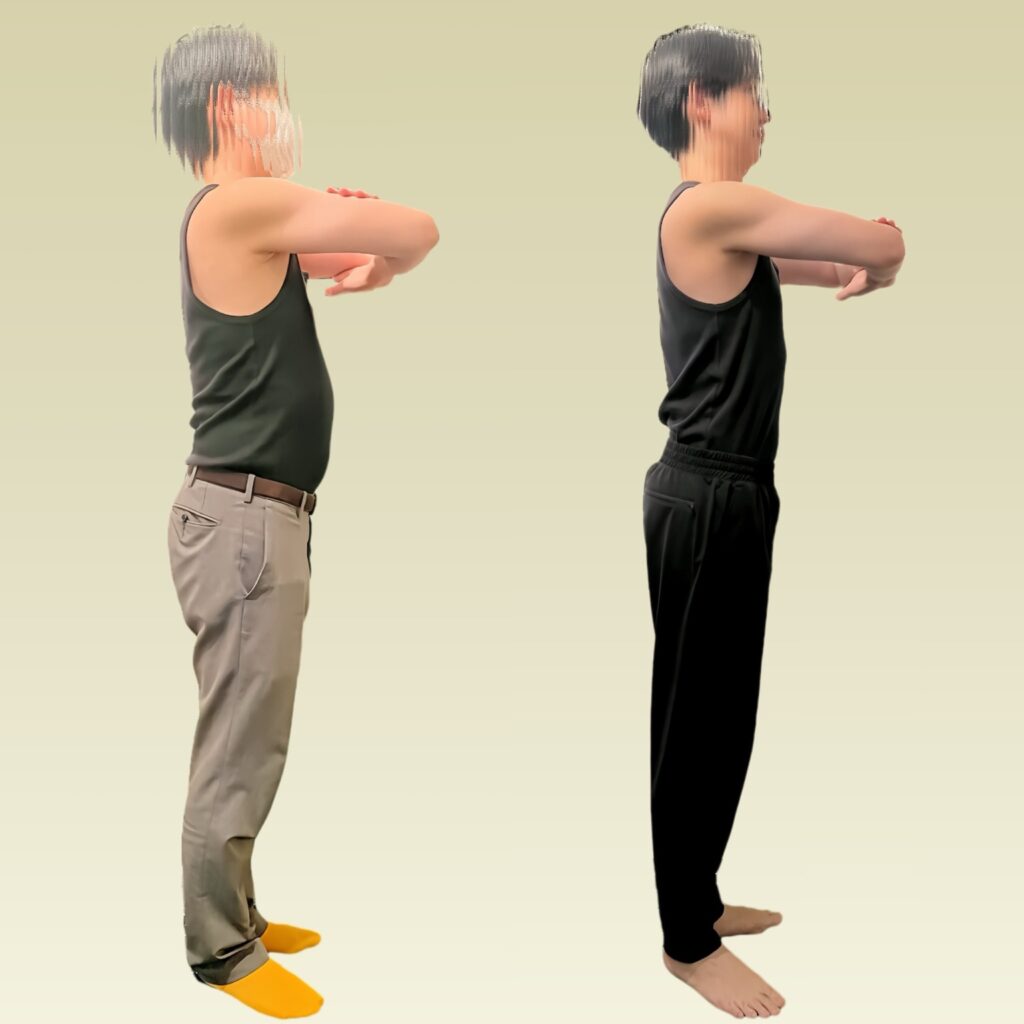 男性のビフォーアフター