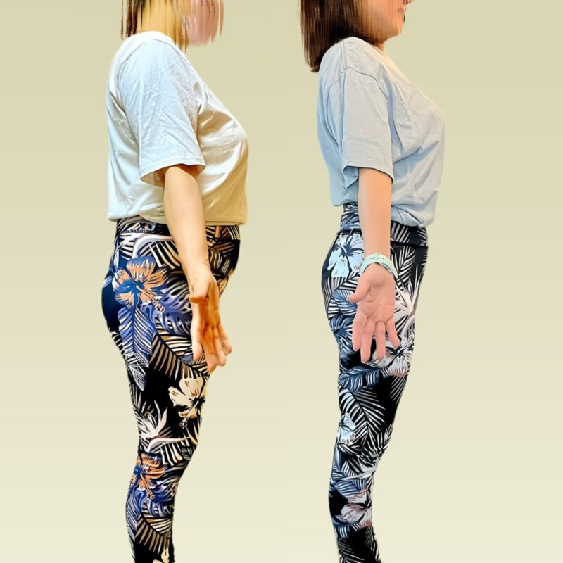 女性のビフォーアフター